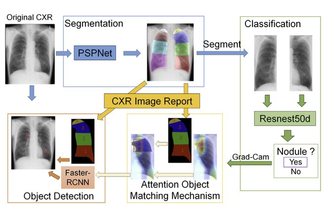 CXR annotations